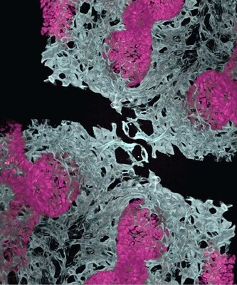 First Lung Organoid with Organ-Specific Blood Vessels