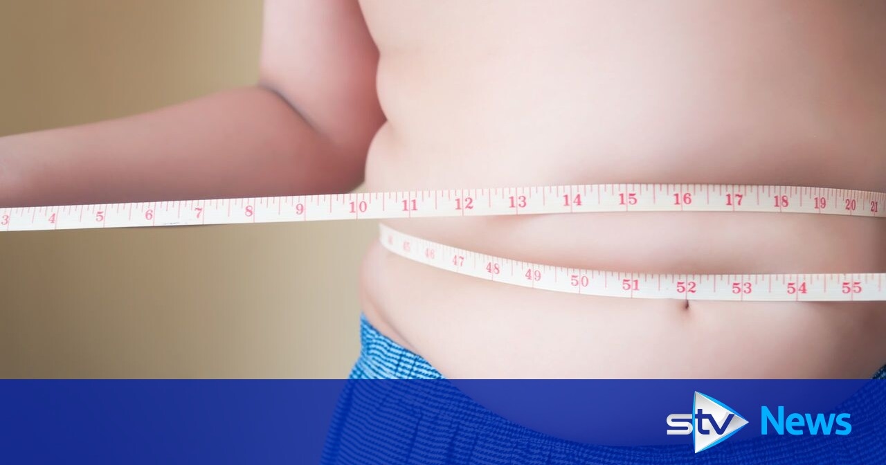Scotland's childhood obesity 'rising' amid calls for tougher action on food
