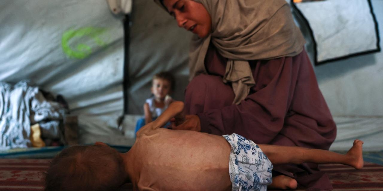 Gaza Starvation Photos Tell a Thousand Lies