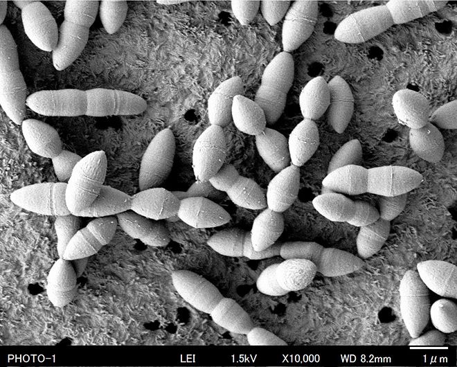 Study finds gut bacterium that raises immune effect to cancer