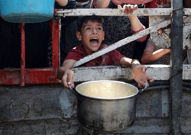 VOX POPULI: Children's lives hang by a thread in Gaza's man-made famine
