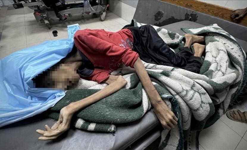 نداء إنساني عاجل: أطفال غزة يموتون جوعًا والمجتمع الدولي مطالب بإنقاذهم فورًا