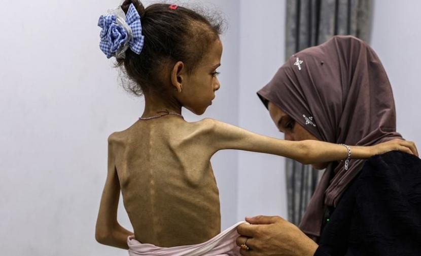 الفاشلون في امتحان الجوع