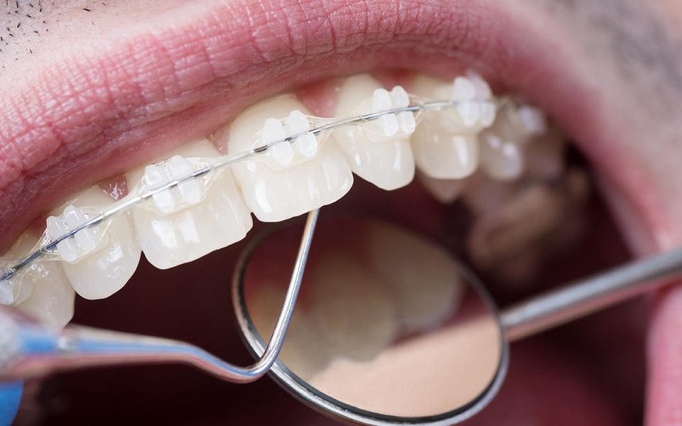 Dentists warn Welsh reforms could ‘destroy NHS dentistry'