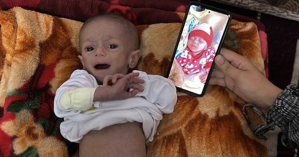 غزة تحت الحصار: سياسة تجويع ممنهجة تهدد حياة الملايين وتدفع الأطفال نحو الهلاك