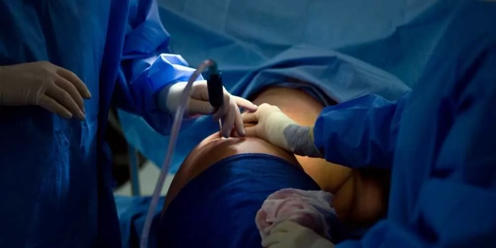 جراحة تجميل تودي بحياة مصممة أزياء شهيرة بطنجة