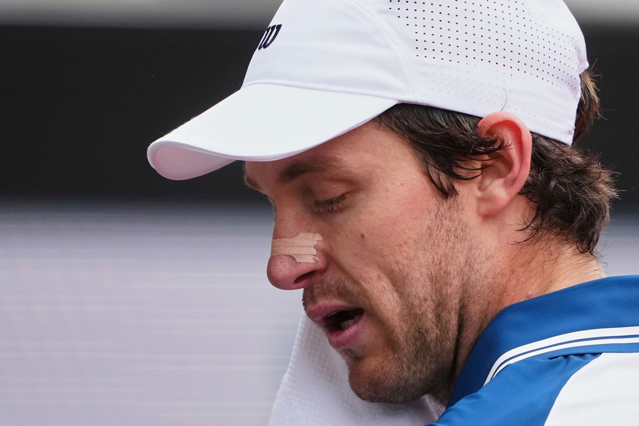 French Open: Tennis players wonder if nasal strips aren't just for snoring anymore