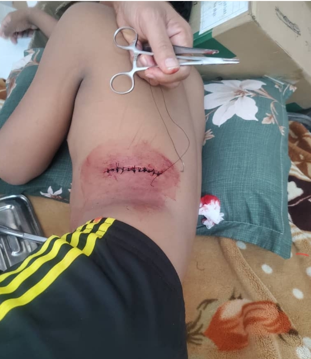 جريمة طعن مروعة تهز عسيلان وشبان أفارقة في قبضة المواطنين