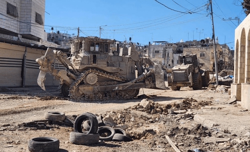 إصابة برصاص الاحتلال خلال عدوان الاحتلال على قباطية بجنين