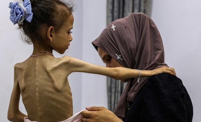 "الأغذية العالمي": نصف مليون فلسطيني في غزة على شفا المجاعة