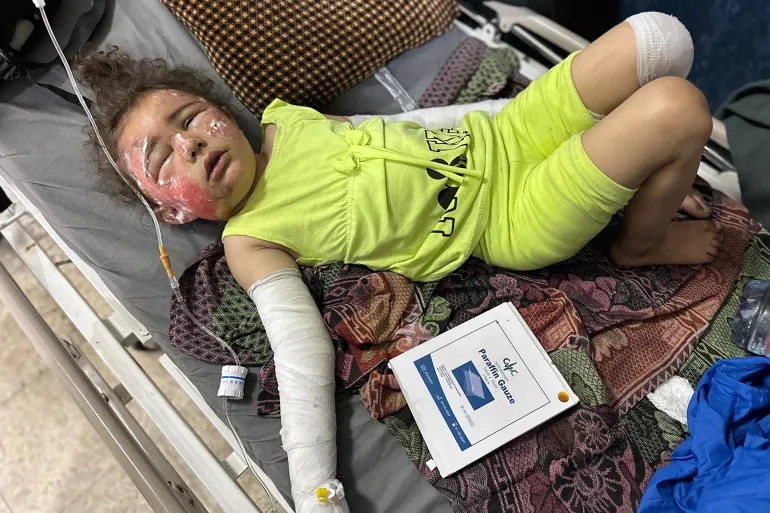 إصابات الحروق القاتلة بلا علاج في غزة