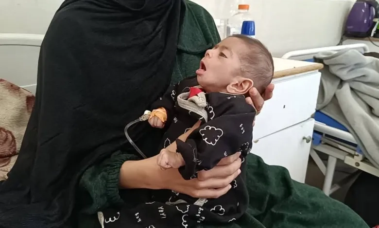 طفلة ثانية تموت جوعا في غزة وألبانيزي: جوعكم عار علينا / شاهد