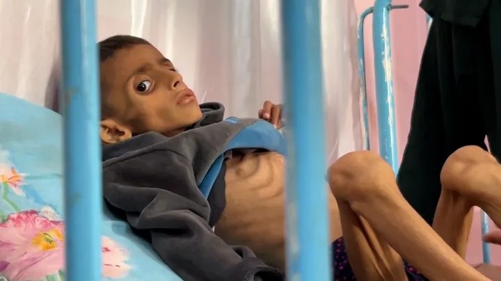 9 وفيات جديدة بسبب الجوع في غزة خلال 24 ساعة