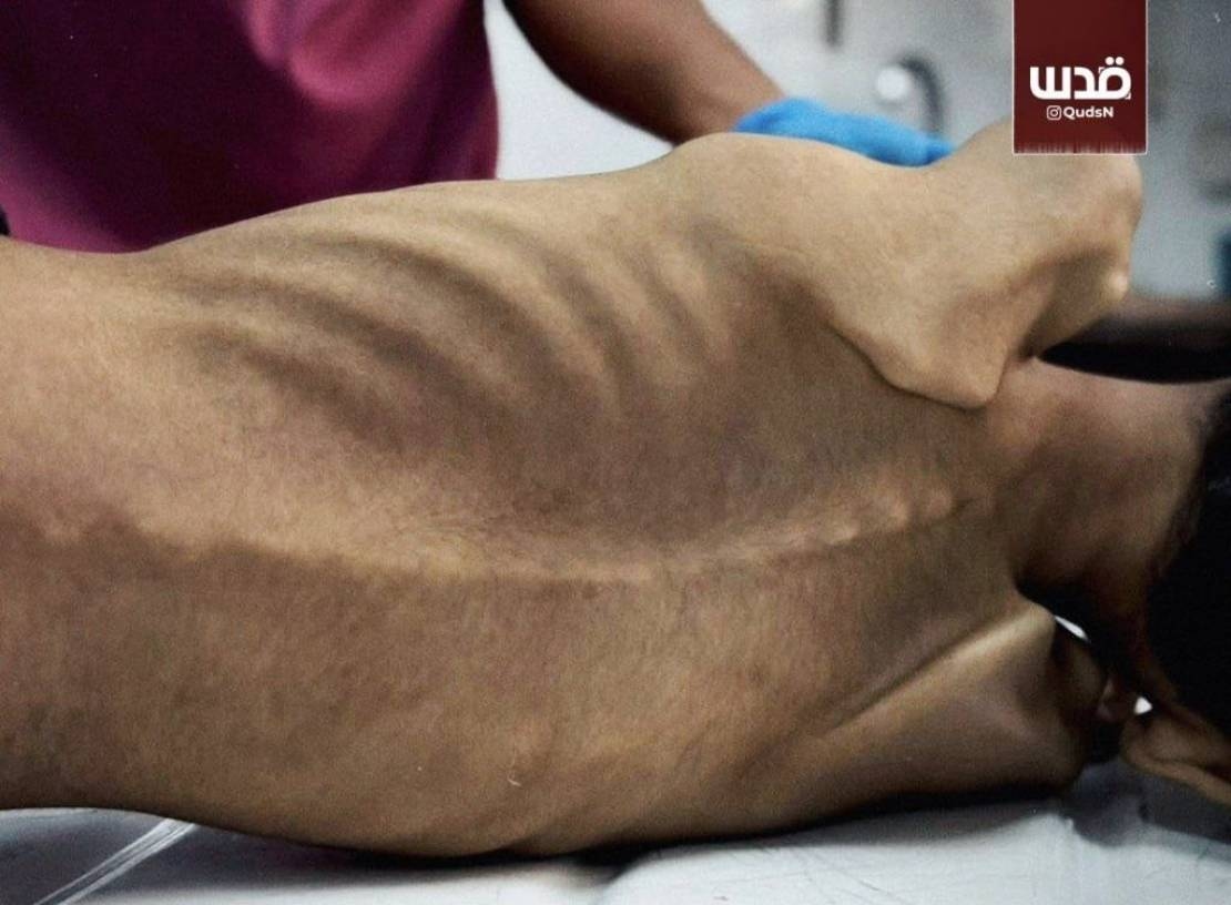 المجاعة في قطاع غزة تدخل مرحلتها الخامسة