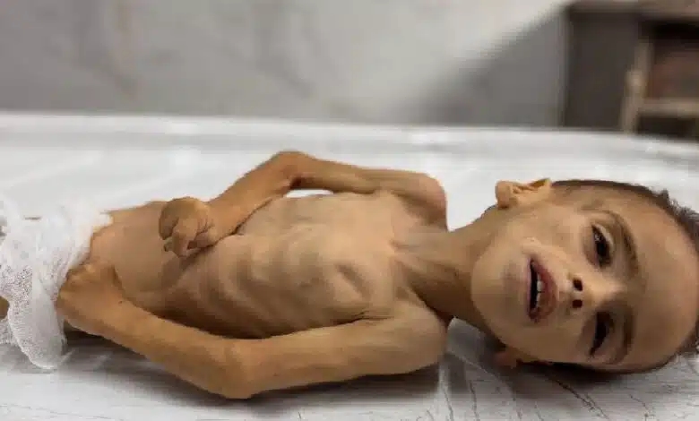 استشهاد رضيع وطفل تجويعا في غزة