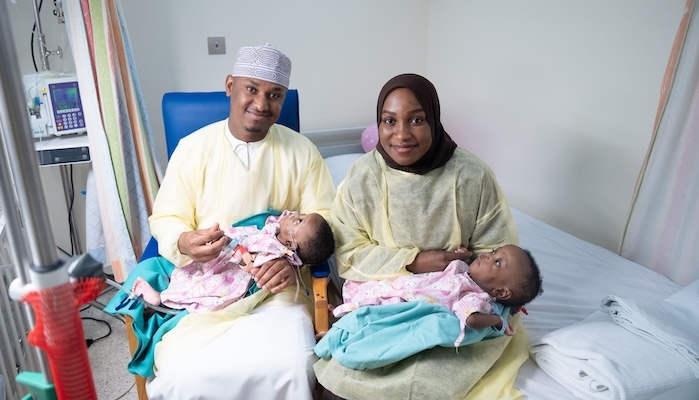 Oman achieves historic conjoined twin separation