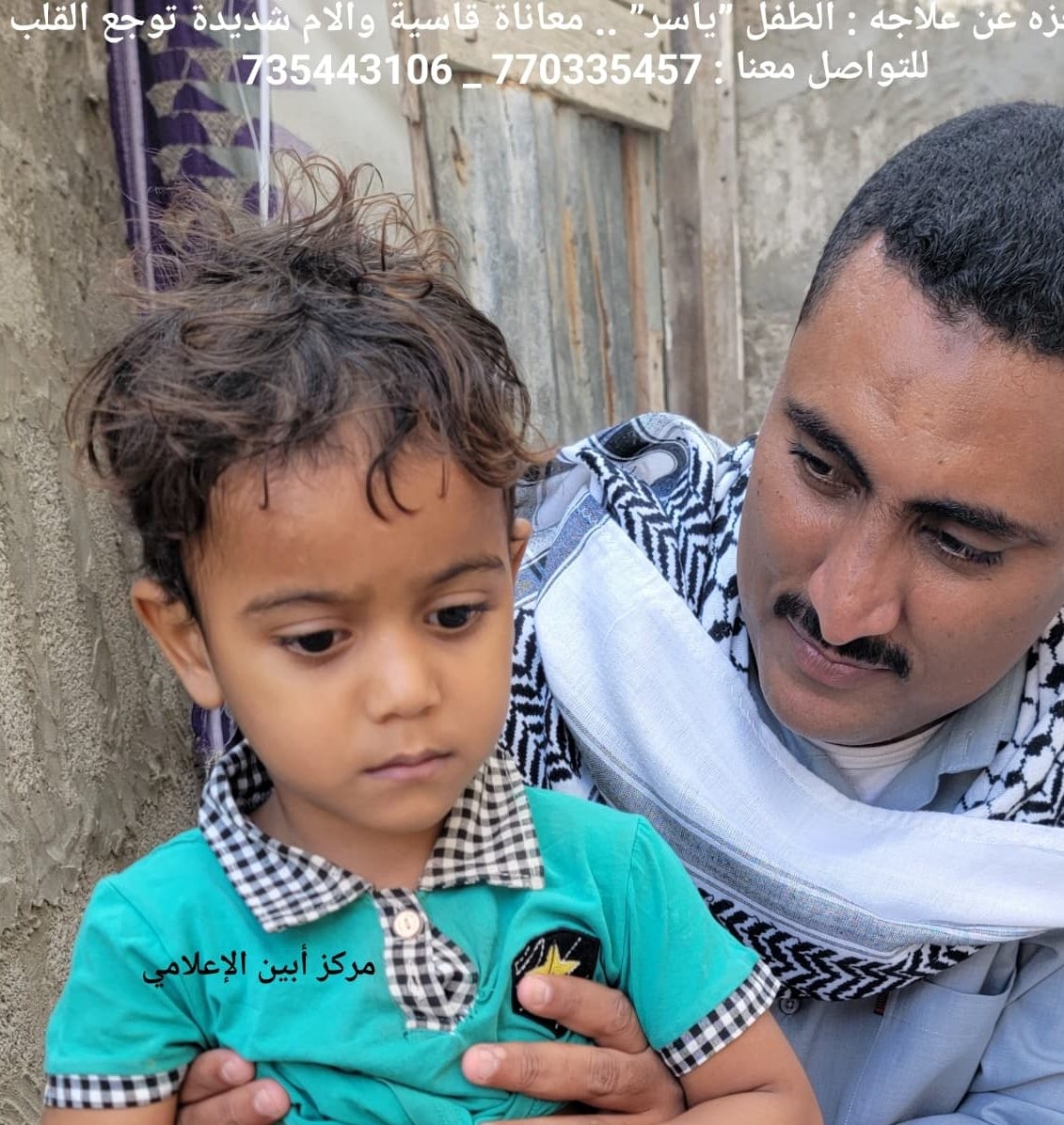 أسرته عاجزه عن علاجه : الطفل 'ياسر' .. معاناة قاسية وآلام شديدة توجع القلب ..!!