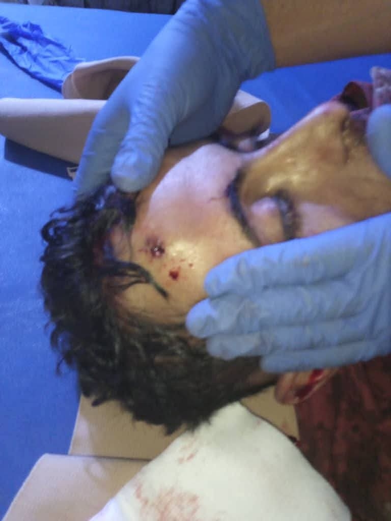 استشهاد جندي برصاص قناص حوثي في جبهة حجر بمحافظة الضالع