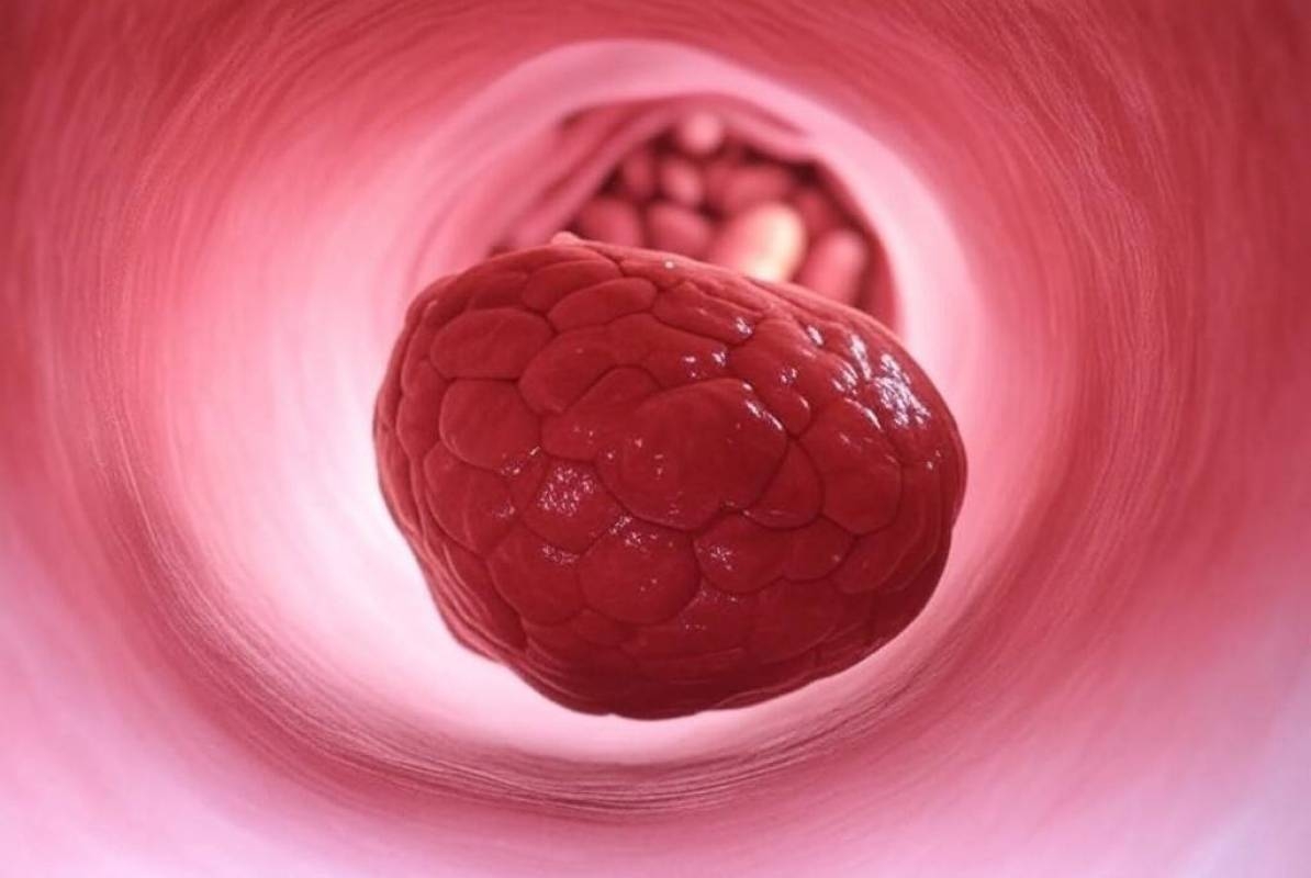 تخثر الدم والإلتهاب... سلاح ذو حدين بين الحماية والمضاعفات الصحيّة