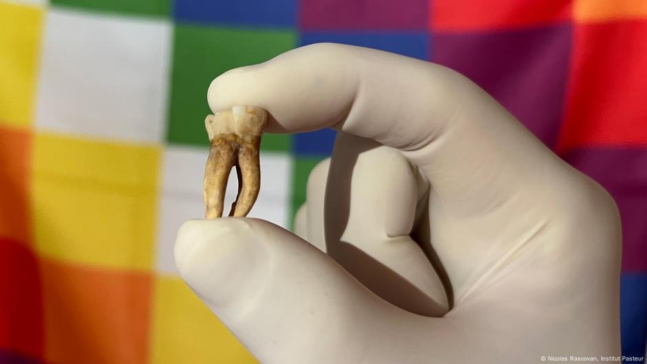 Secret leprosy infected the Americas before European arrival – DW – 06/04/2025