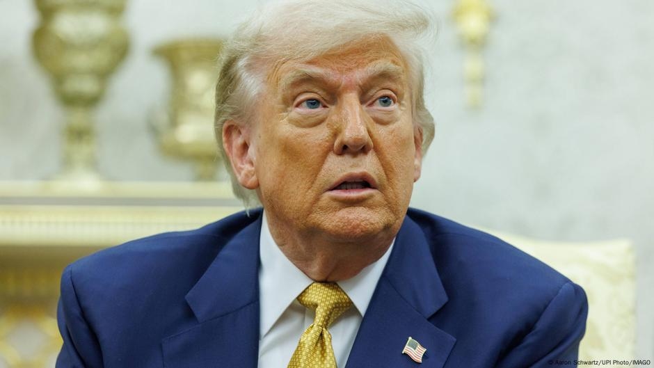 Trump receives vein issue diagnosis amid leg swelling rumors – DW – 07/18/2025