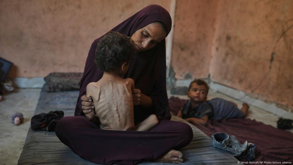 Middle East: Famine 'playing out' in Gaza — monitor – DW – 07/29/2025