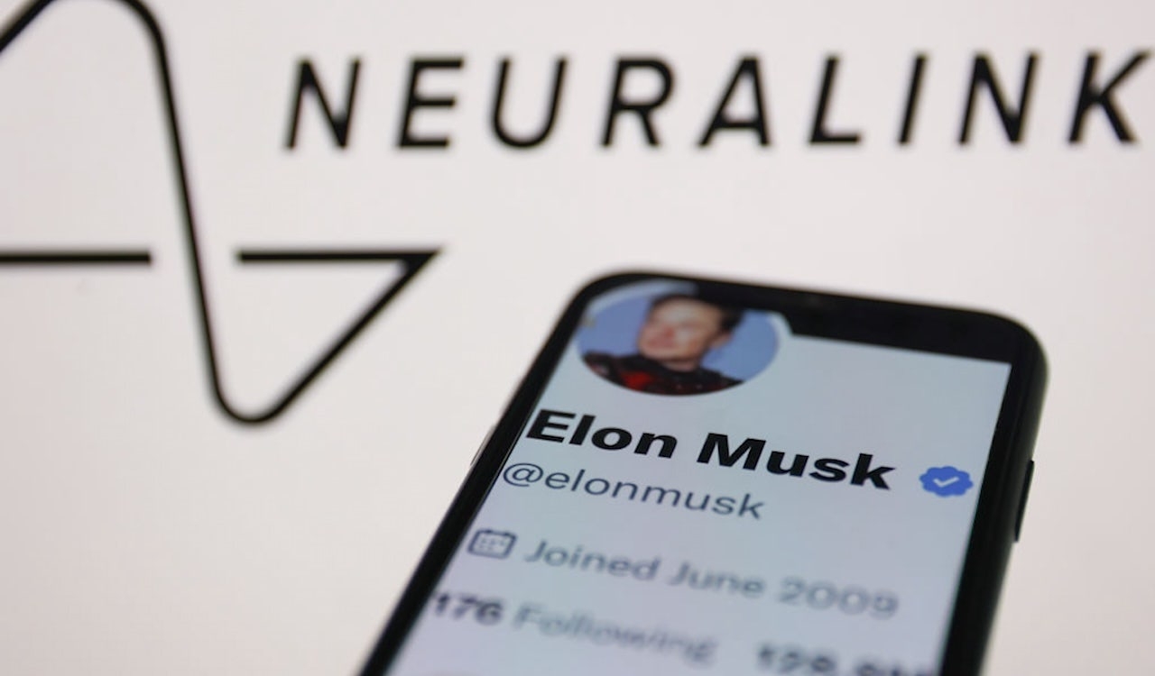 Neuralink brain implant helps Arizona man regain control of his life