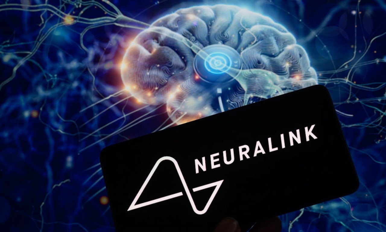 Paralyzed man with ALS is third to receive NeuraLink implant, can type with brain