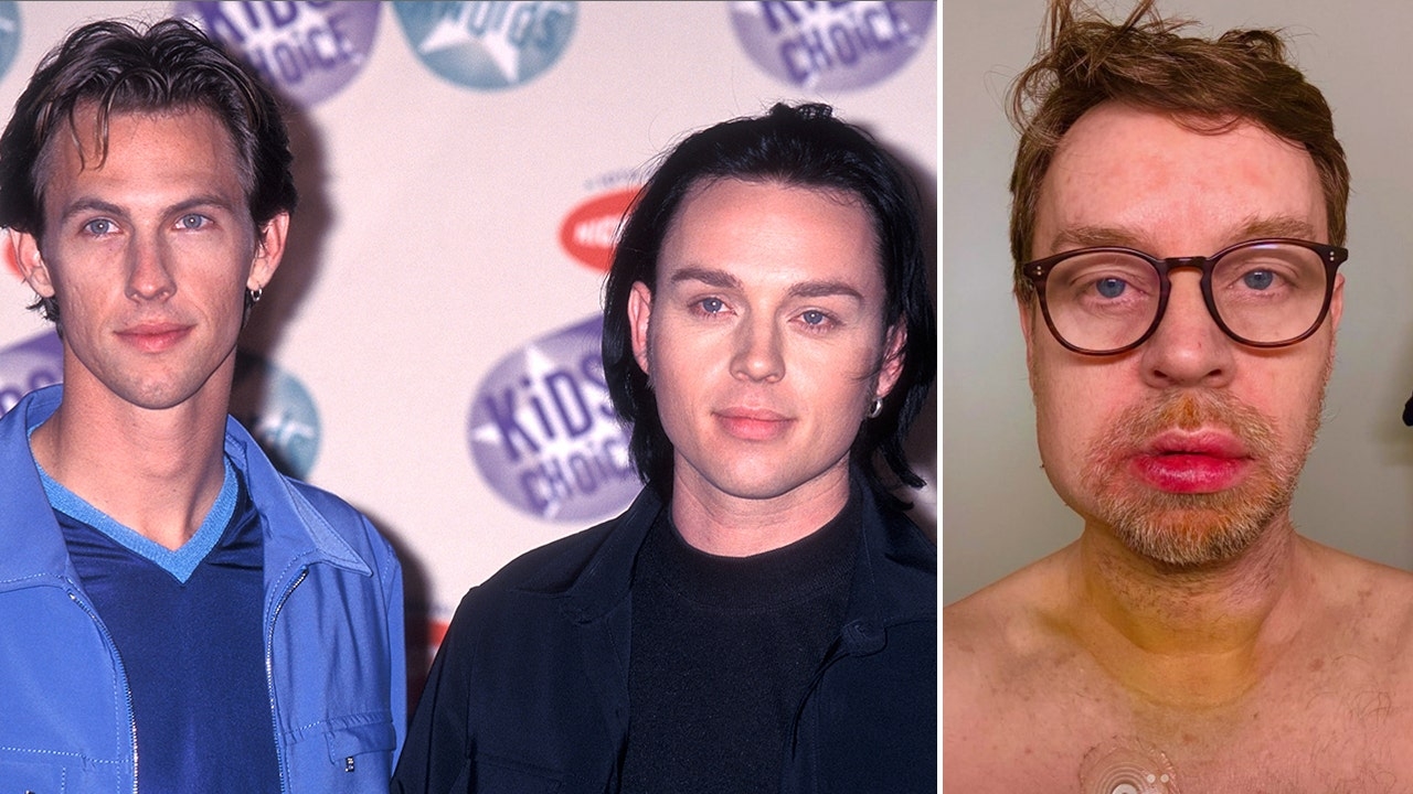 Savage Garden singer suffered ‘terrible accident' two months after his mother passed away