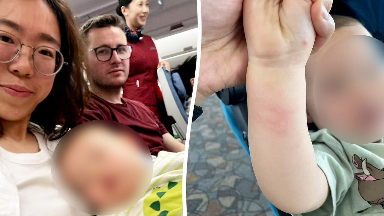 Family kicked off flight over son's insect bites despite doctor's approval