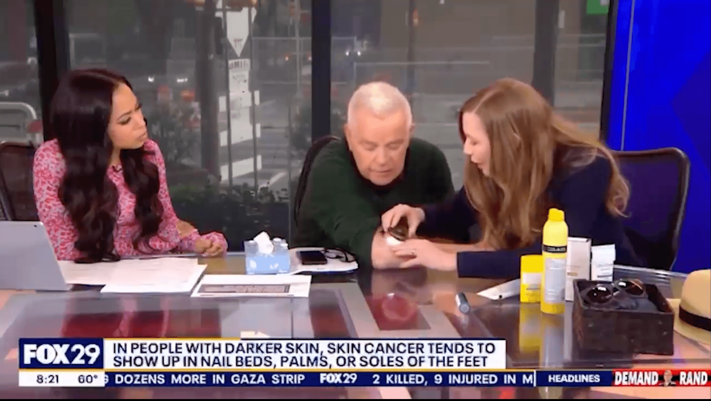 TV host discovers he has skin cancer during live on-air broadcast