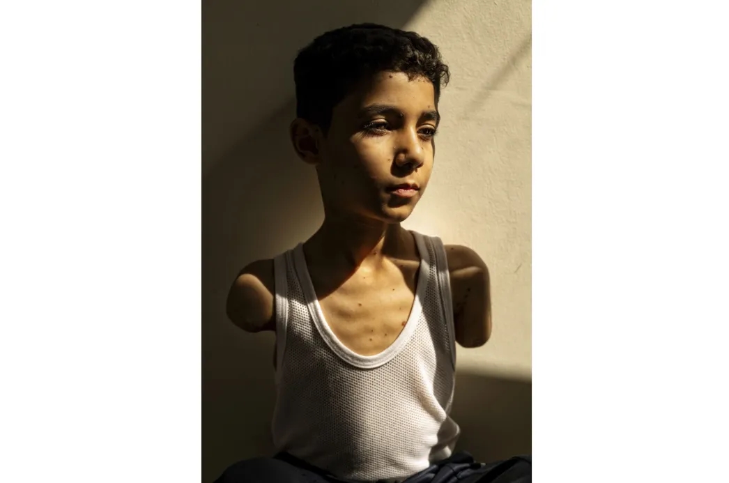 Amputee Palestinian Boy Image Wins World Press Photo Award