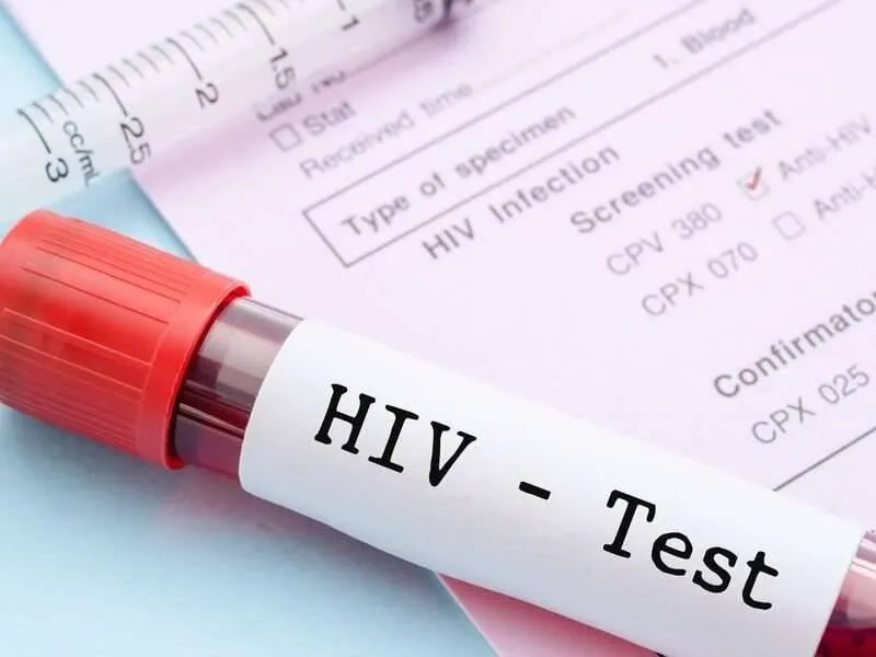 نهج جديد للقاحات المضادة لفيروس نقص المناعة البشرية يظهر نتائج مبكرة واعدة