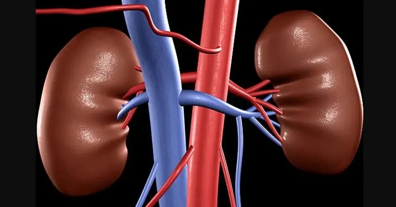 للتخلص من حصوات الكلى... 5 علاجات طبيعية يمكنك اتباعها في المنزل