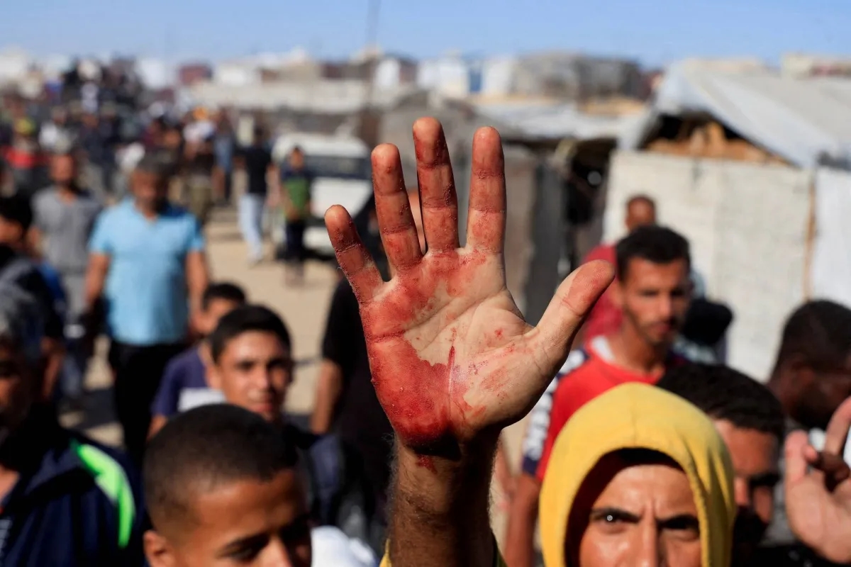 الأونروا: القناصة الإسرائيليون بغزة يطلقون النار على منتظري المساعدات وكأن لديهم رخصة للقتل