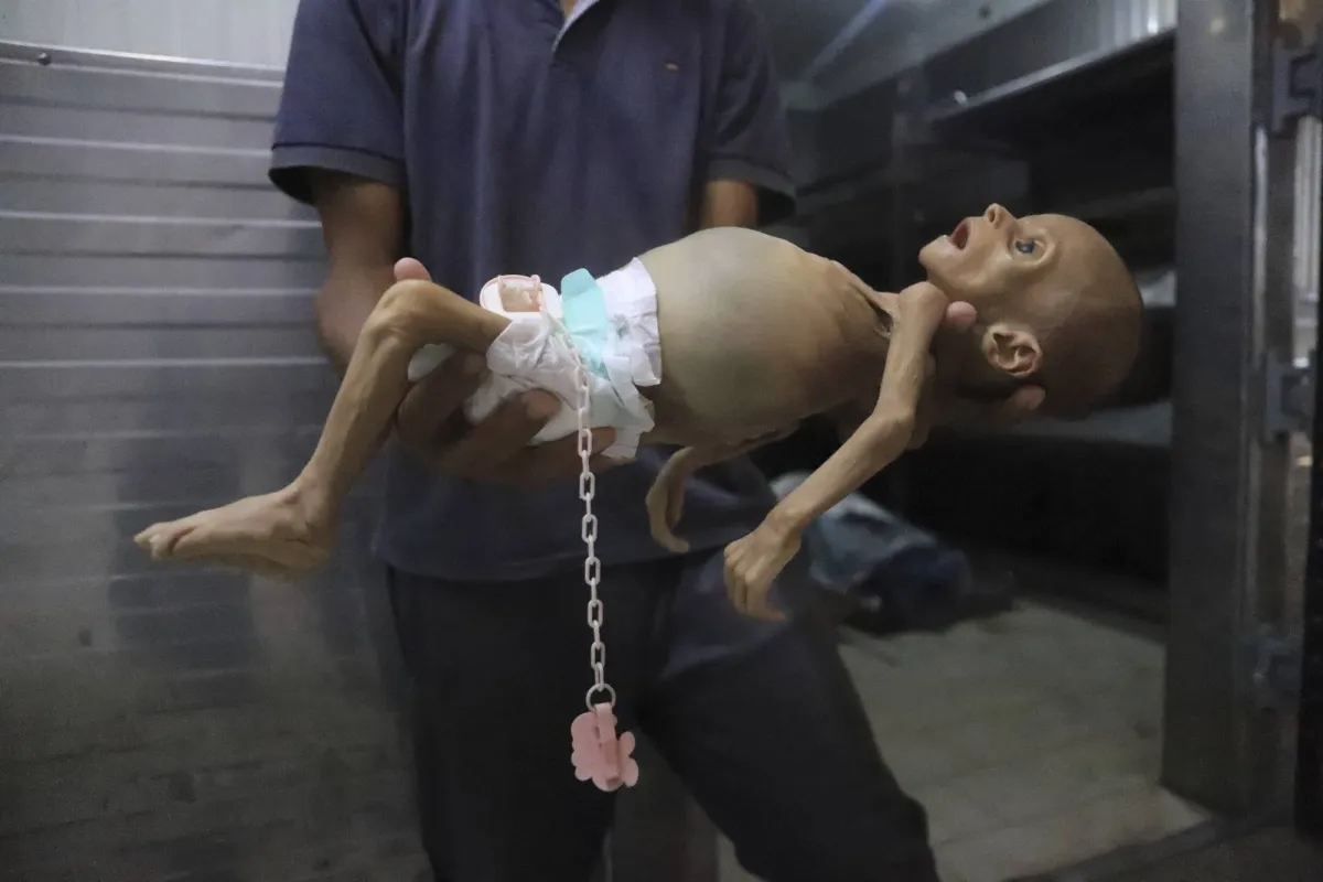 رئيس وزراء أستراليا يتهم إسرائيل بانتهاك «واضح» للقانون الدولي في غزة