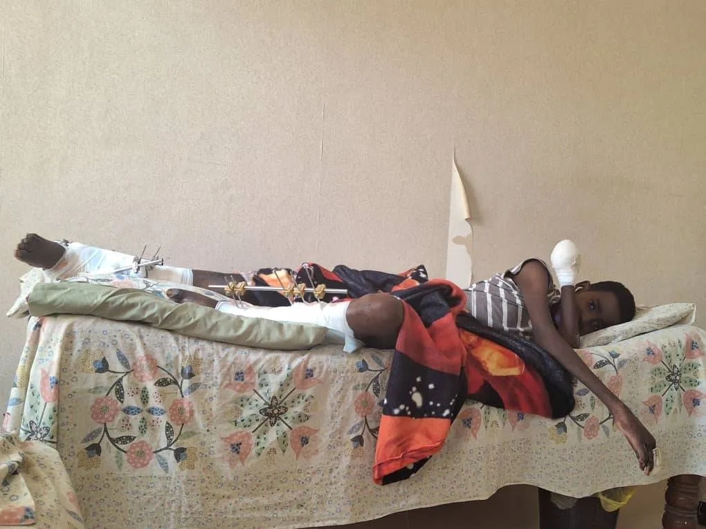 السودان: الأجسام المتفجرة تشوه أجساد 15 ألف طفل