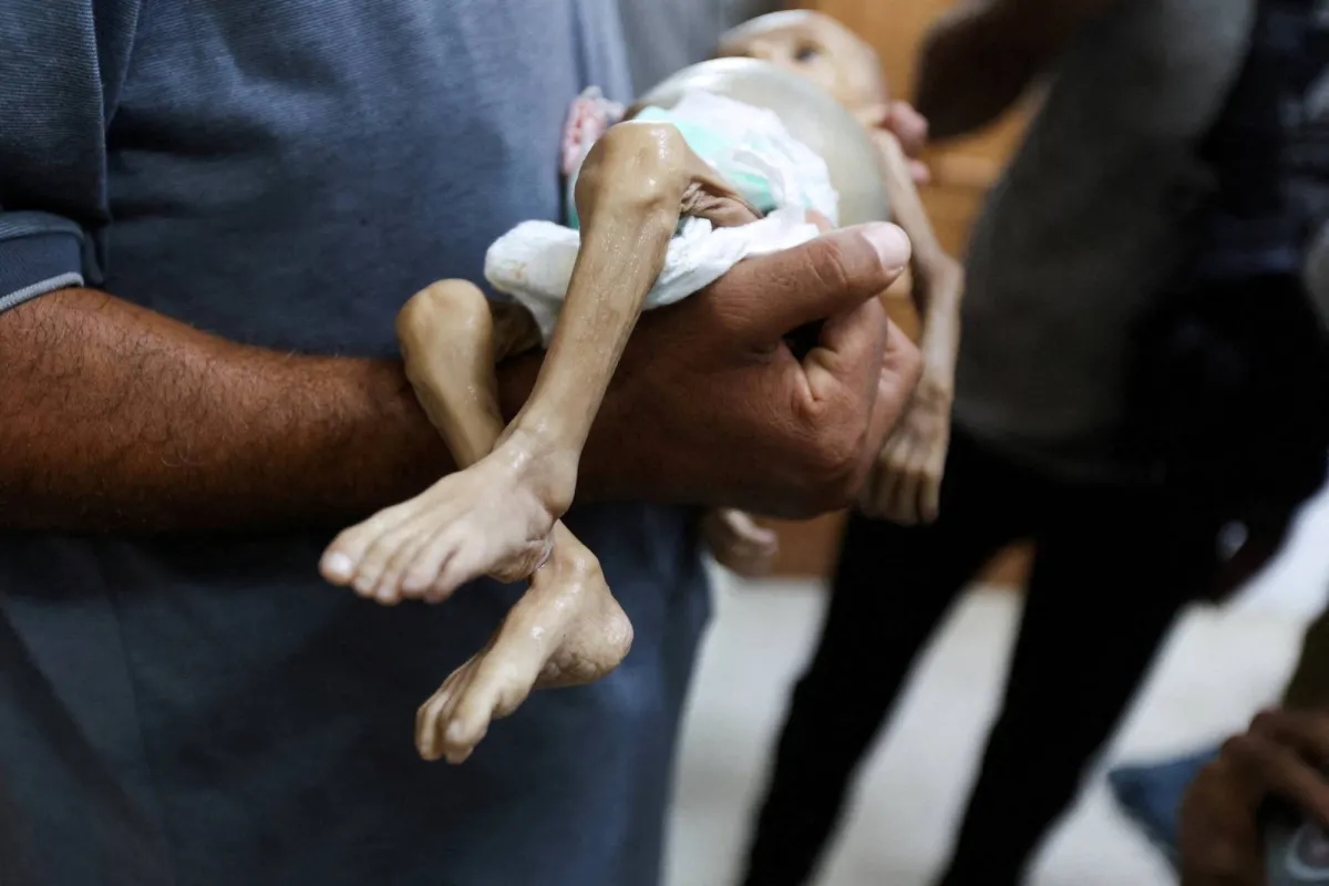 «أسوأ مجاعة» في غزة تفتك بأطفالها