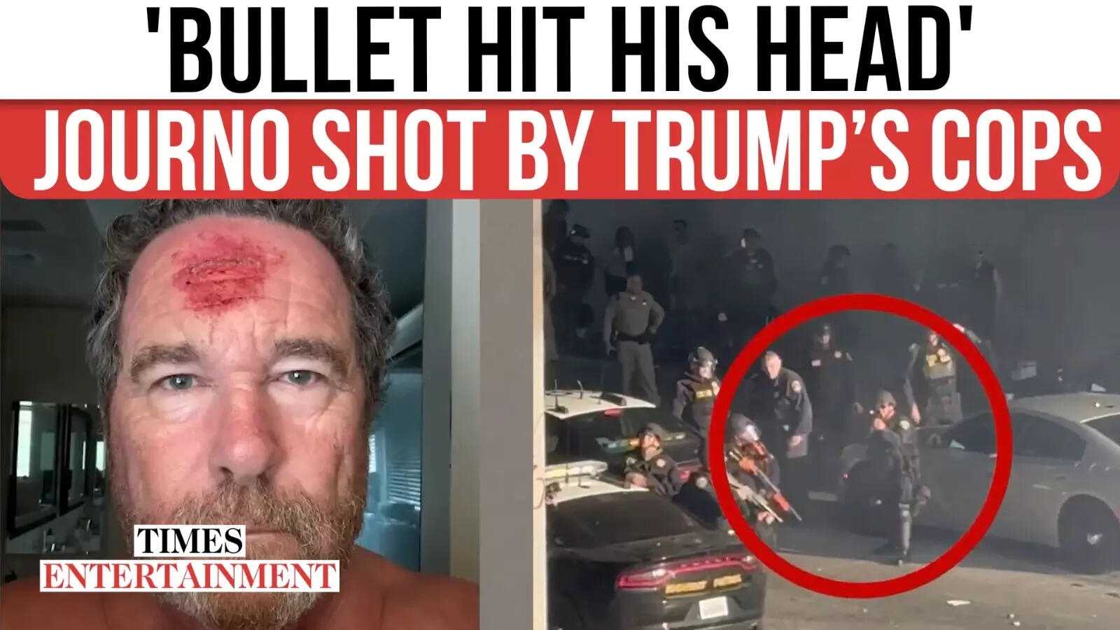 LAPD Shoots Journalist Covering ICE Protest: Photographer Toby Canham Shot In Head