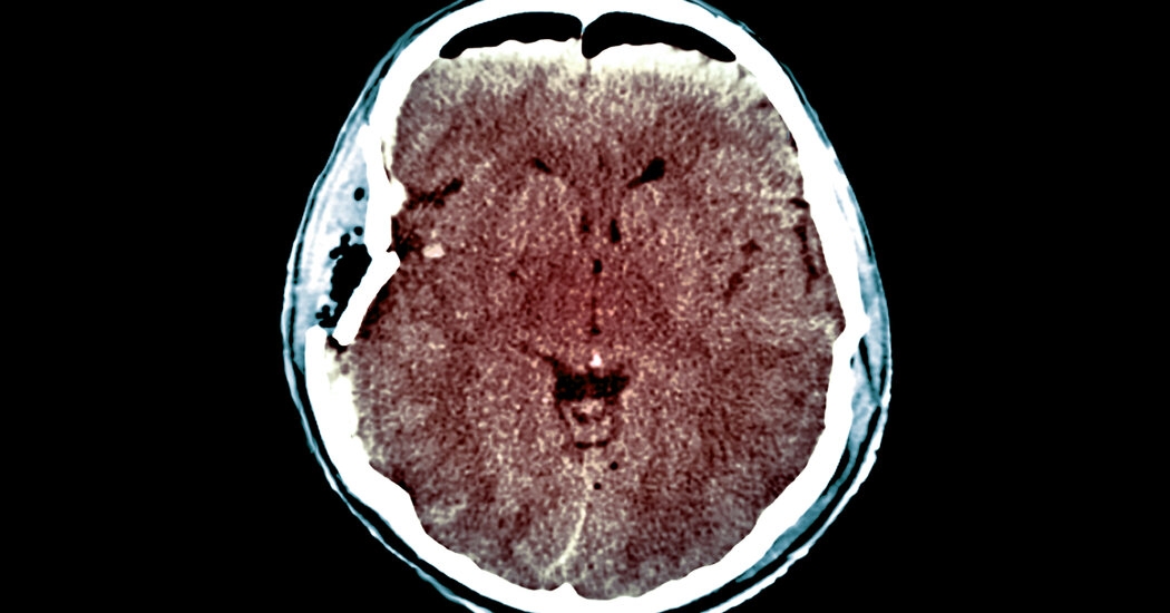 A New System Aims to Save Injured Brains and Lives