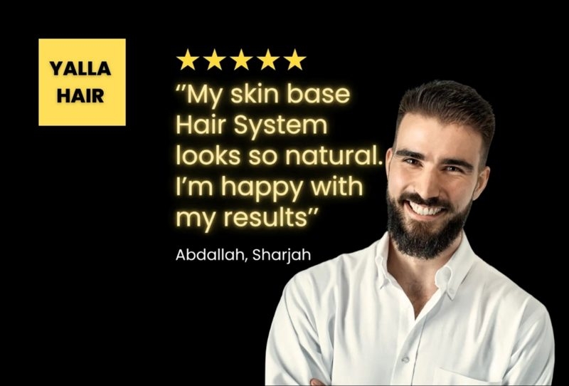 Yalla Hair Offers Hope to Men Battling Hair Loss with Non-Surgical Hair Solutions in Dubai