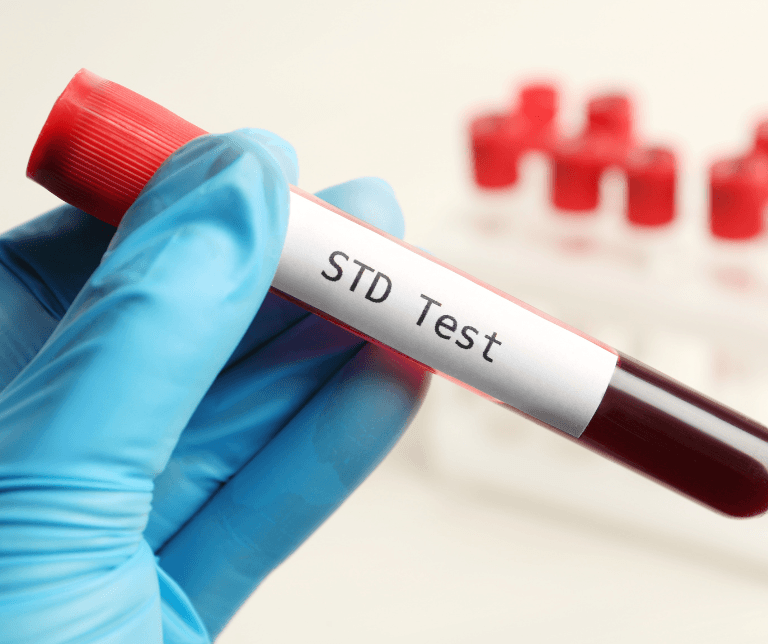 STD Test Dubai: Ensuring Health and Peace of Mind