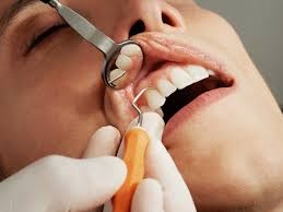 Meet Your Trusted Dental Implant Specialist in Lake Mary