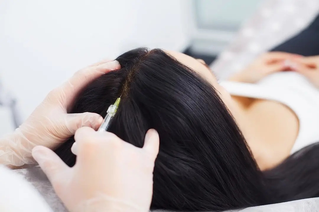 Innovations in Hair Transplantation: Exploring New Techniques and Future Trends