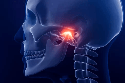 Jaw Pain – Why Is My Jaw Hurting and How to Get Rid of the Pain
