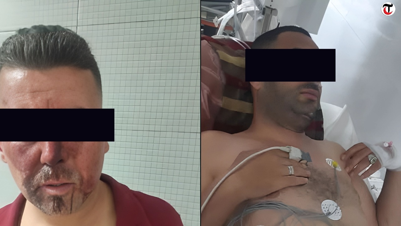 Tunisie Telegraph القصرين: براكاج يحيل شخصين على المستشفى.. أحدهما في الإنعاش