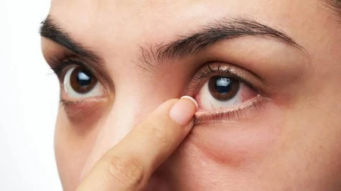 توجه للطبيب فورا.. خبراء يكشفون عن 5 علامات في العين تشير إلى وجود مشكلات بالكلى