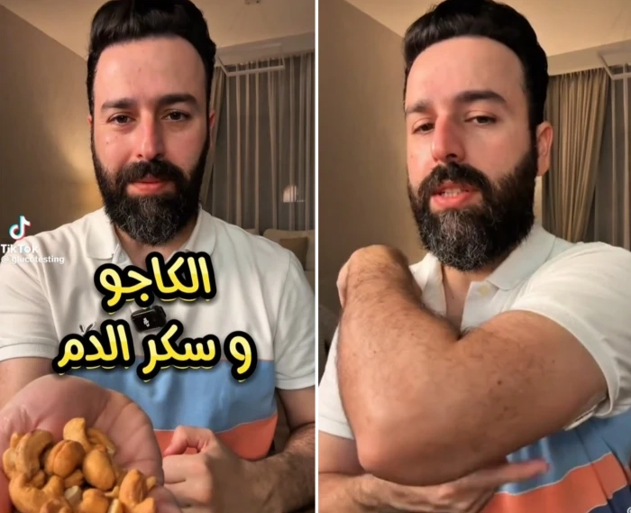 بالفيديو: مختص يجري تجربة فحص سكر الدم بعد ساعتين من تناول الكاجو.. ويكشف النتيجة