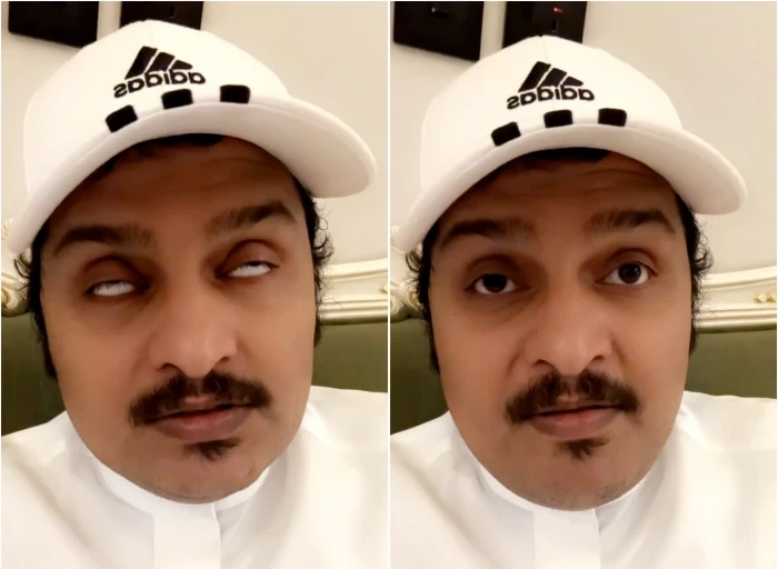 شاهد.. "الصبحان" يصدم الجمهور ويكشف توقعه لنتيجة مواجهة الهلال وريال مدريد اليوم