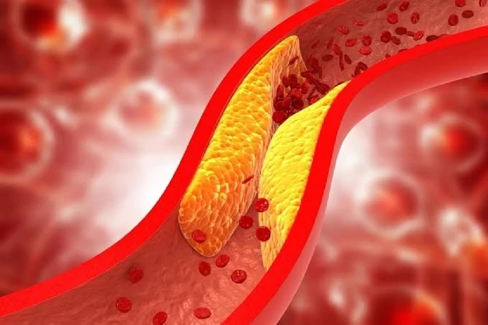 الكشف عن 11 مشروبًا طبيعيًا لخفض الكوليسترول وحماية القلب